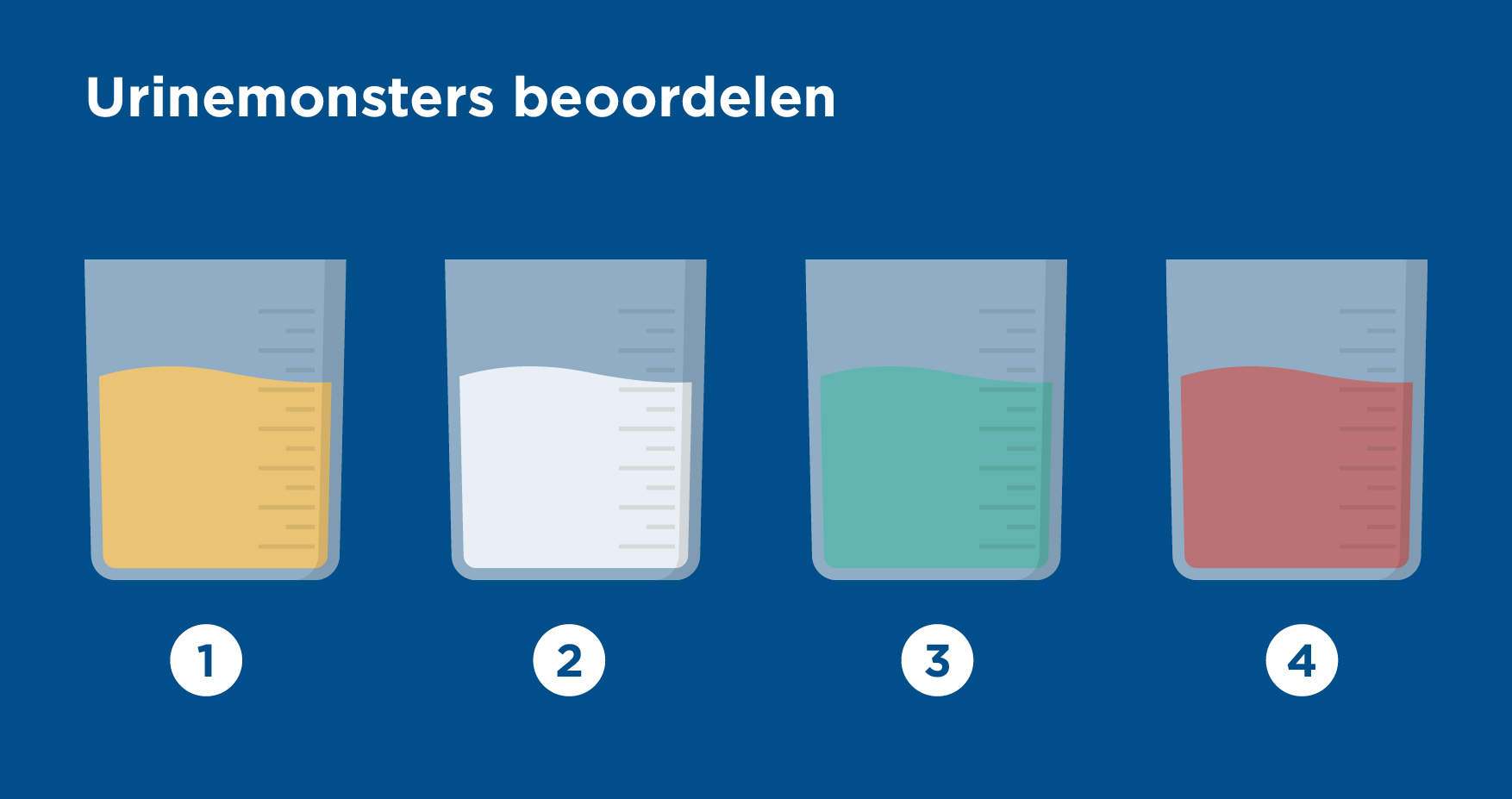 Urinemonsters beoordelen