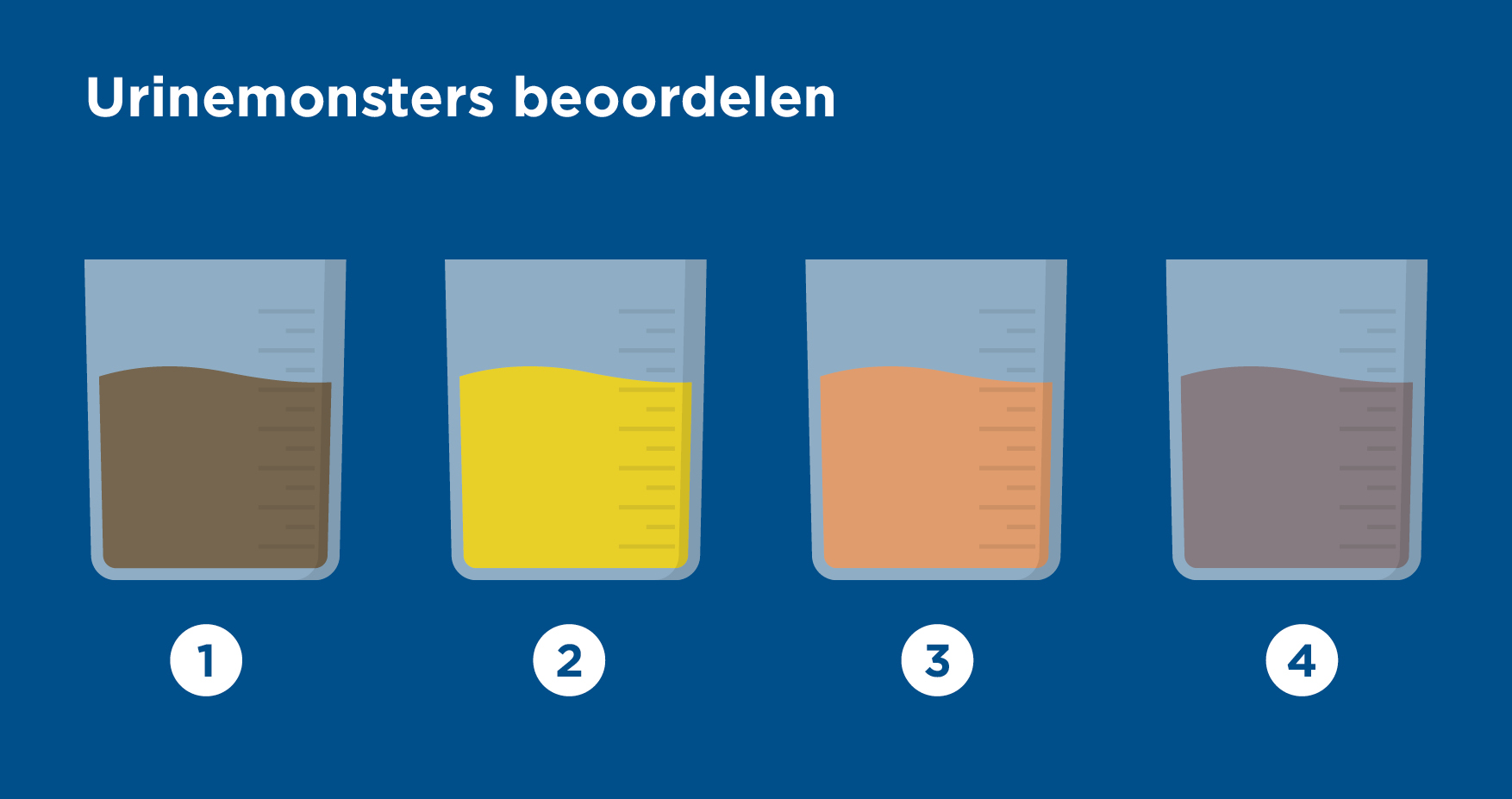 Urineonderzoek